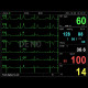 Monitor multiparametrico PC-3000 Monitor multiparametrico PC-3000